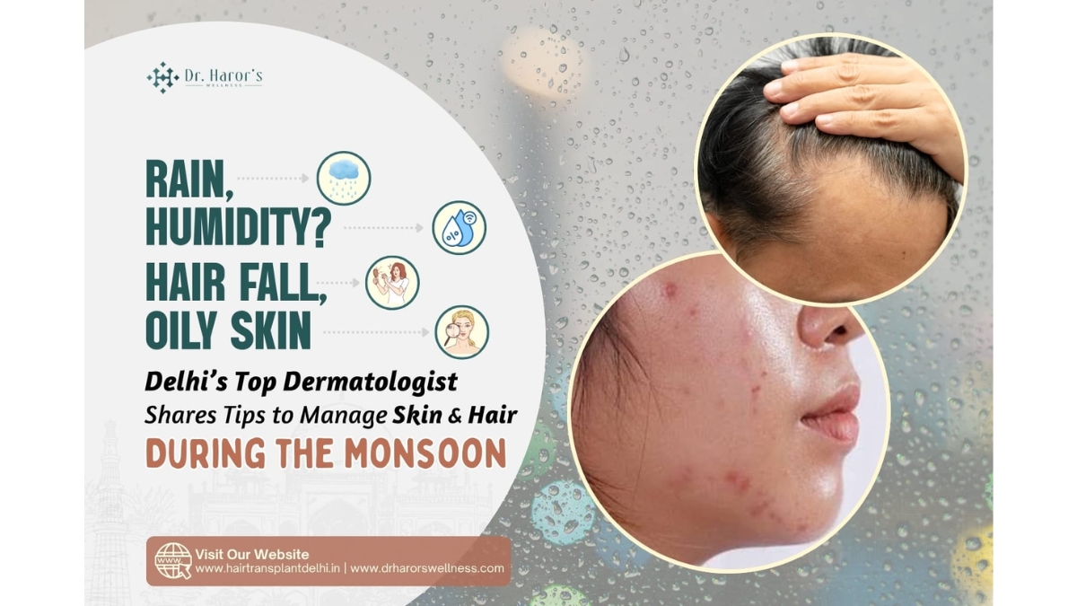 Rain, Humidity, Hair Fall, Oily Skin? Delhi’s Top Dermatologist Shares Tips to Manage Skin & Hair During the Monsoon
